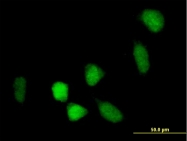 H00054880-B01P - Bcl-6 corepressor