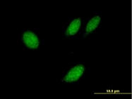 H00054957-B02 - TXNL4B / DIM2