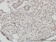 H00054961-M01 - SSH3