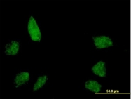 H00054971-B01 - BANP / SMAR1
