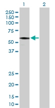 H00055081-D01P - HIP1-interacting protein