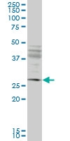 H00055081-M02 - HIP1-interacting protein