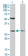 H00055081-M04 - HIP1-interacting protein