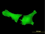 H00055105-B01 - GPATCH2
