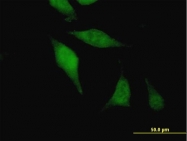 H00055109-B02 - AGGF1 / VG5Q