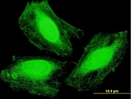 H00055156-B01P - ARMC1 / ARCP