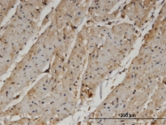 H00055229-M04 - PANK4