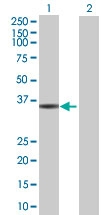 H00055328-B01 - Renalase