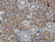 H00055330-M02 - Cappuccino homolog