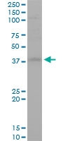 H00055359-M02 - STYK1 / NOK