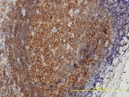 H00055466-M01 - DNAJA4