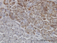 H00055521-M01 - TRIM36 / RNF98
