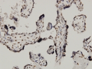 H00055602-M02 - CDKN2AIP / CARF