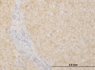 H00055624-M07 - POMGNT1