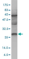 H00055686-M01 - Melanoregulin