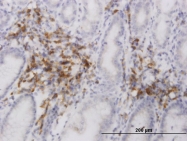 H00055741-M01 - EDEM2