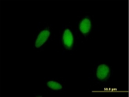 H00055769-B01 - ZNF83