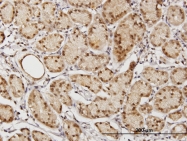 H00055815-B01P - TSNAXIP1 / TXI1
