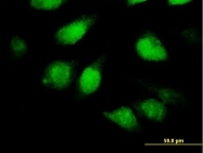 H00055815-B01P - TSNAXIP1 / TXI1