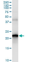 H00055829-D01 - Selenoprotein S (SELS)