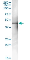 H00055869-D01 - HDAC8