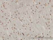 H00055905-M01 - RNF114