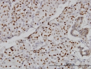 H00055907-M01 - CMAS