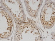 H00055929-M01 - DMAP1