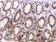 H00055973-M07 - BCAP29 / BAP29
