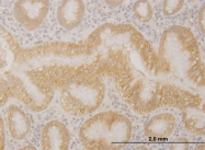 H00056139-M01 - PCDHA10