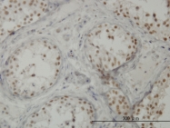 H00056259-M01 - CTNNBL1
