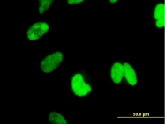 H00056259-M01 - CTNNBL1