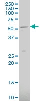 H00056606-A01 - SLC2A9 / GLUT9