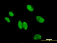 H00056647-B01 - BCCIP / TOK1