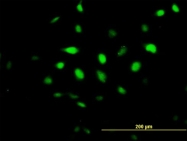 H00056647-B02P - BCCIP / TOK1