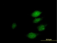 H00056940-B01P - MAP Kinase Phosphatase X