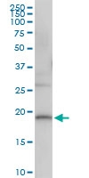 H00056940-D01 - MAP Kinase Phosphatase X