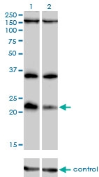 H00056940-M01 - MAP Kinase Phosphatase X