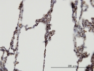 H00056949-M01 - SYF1 / XAB2