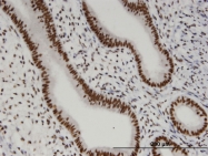 H00056957-M01 - ZA20D1