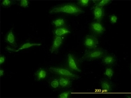 H00057016-M01 - AKR1B10