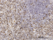 H00057126-M01 - CD177