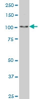 H00057167-M03 - Sal-like protein 4 (SALL4)