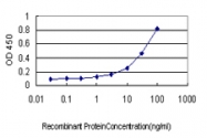H00057167-M03 - Sal-like protein 4 (SALL4)