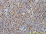 H00057175-M01 - Coronin-1B