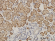 H00057522-M03 - ARHGAP13 / SRGAP1