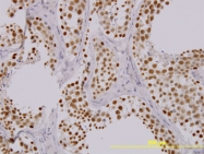 H00057551-M01 - TAO Kinase 1 (TAOK1)