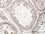 H00057663-M01 - USP29