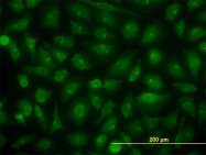 H00057805-M04 - KIAA1967