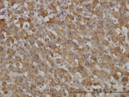 H00057817-M02 - Hepcidin / HAMP